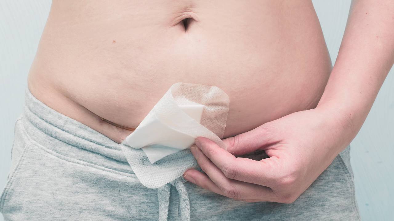 New Mom with Cesarean Section