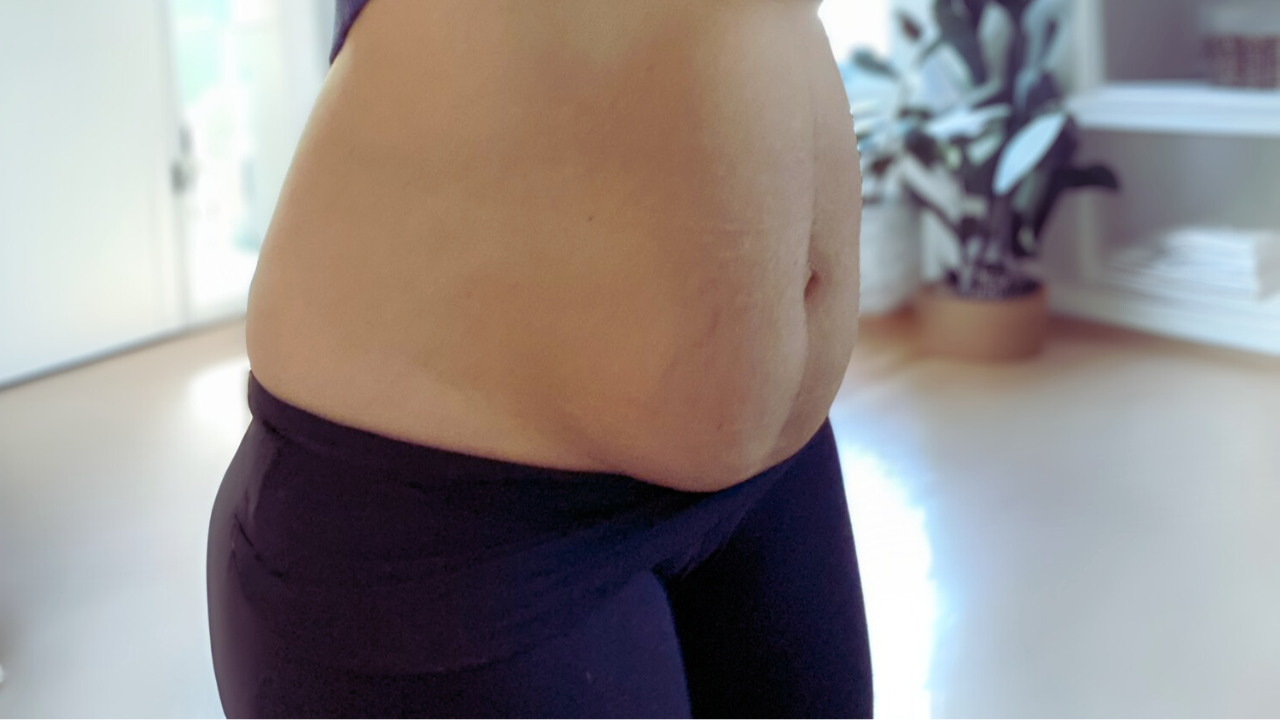 C-section mom doing exercise