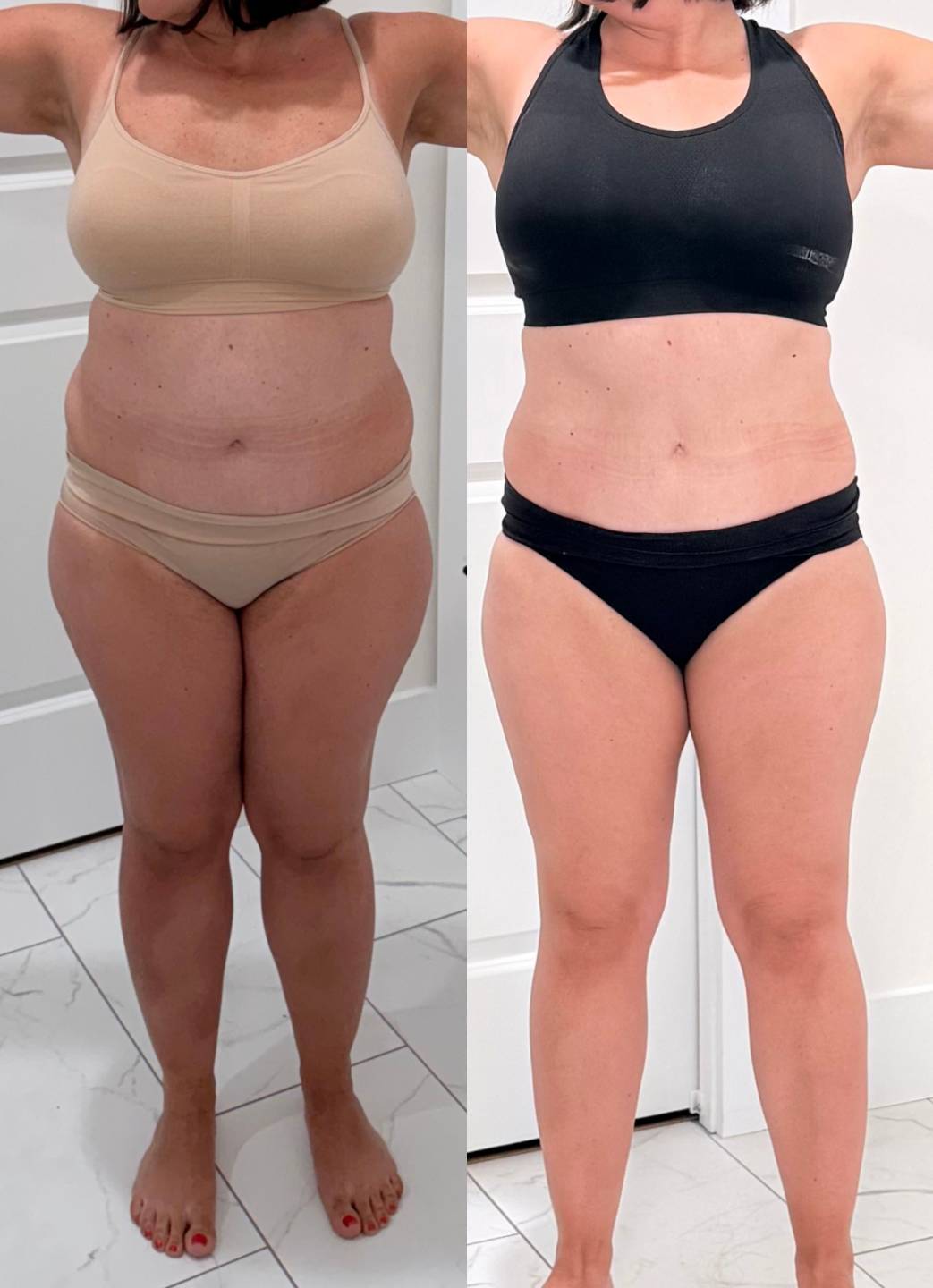 Transformación 1