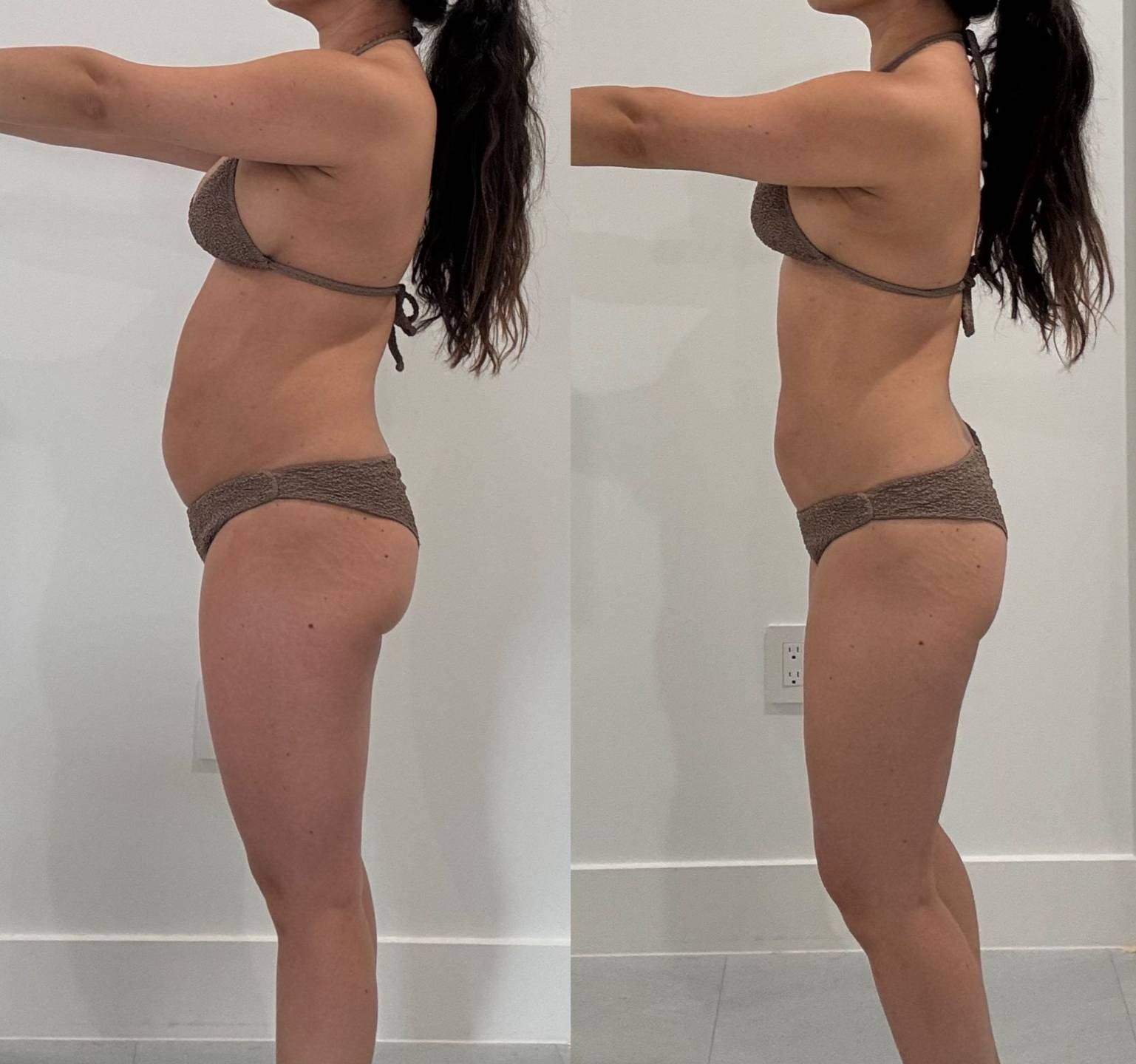 Transformación 2