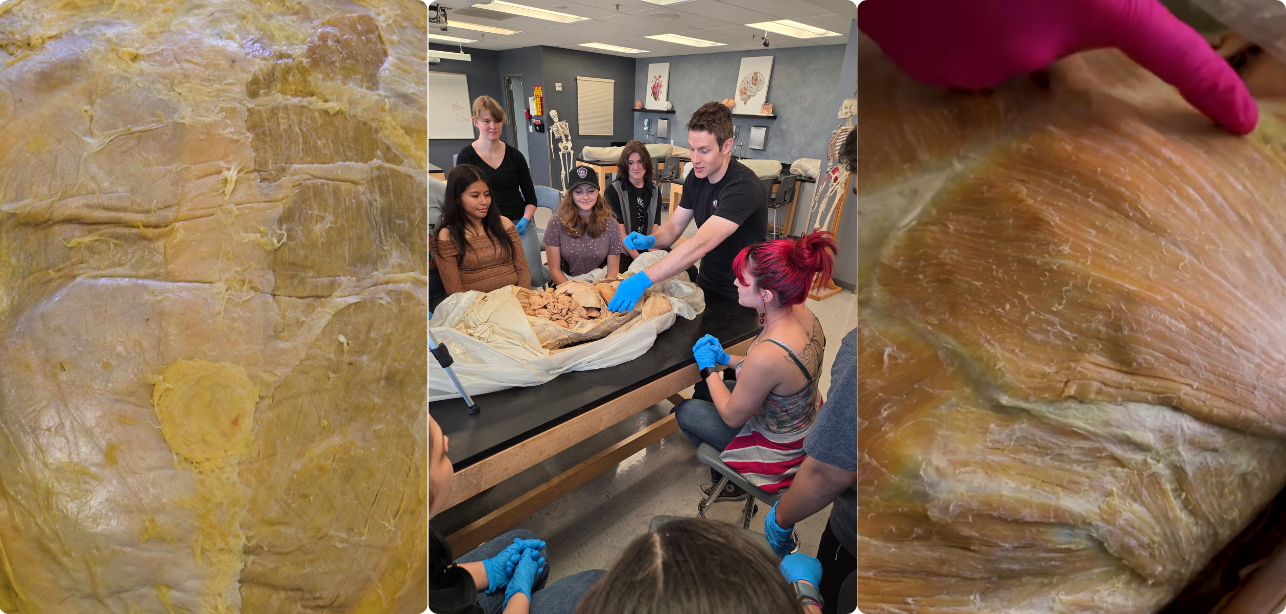   IOHA Live from the Lab: Musculoskeletal System: Body Wall 2-Hour Workshop