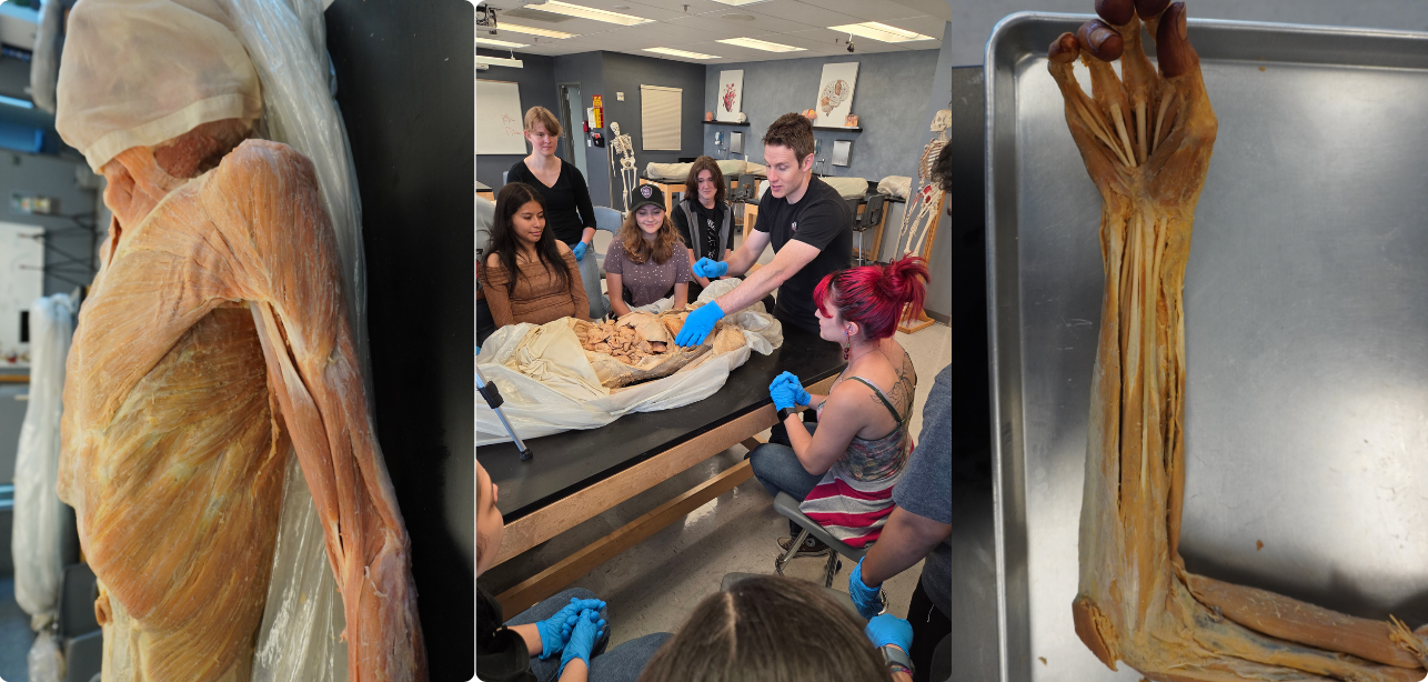 Musculoskeletal System: Superior Limb 2-Hour Workshop - Institute of Human Anatomy