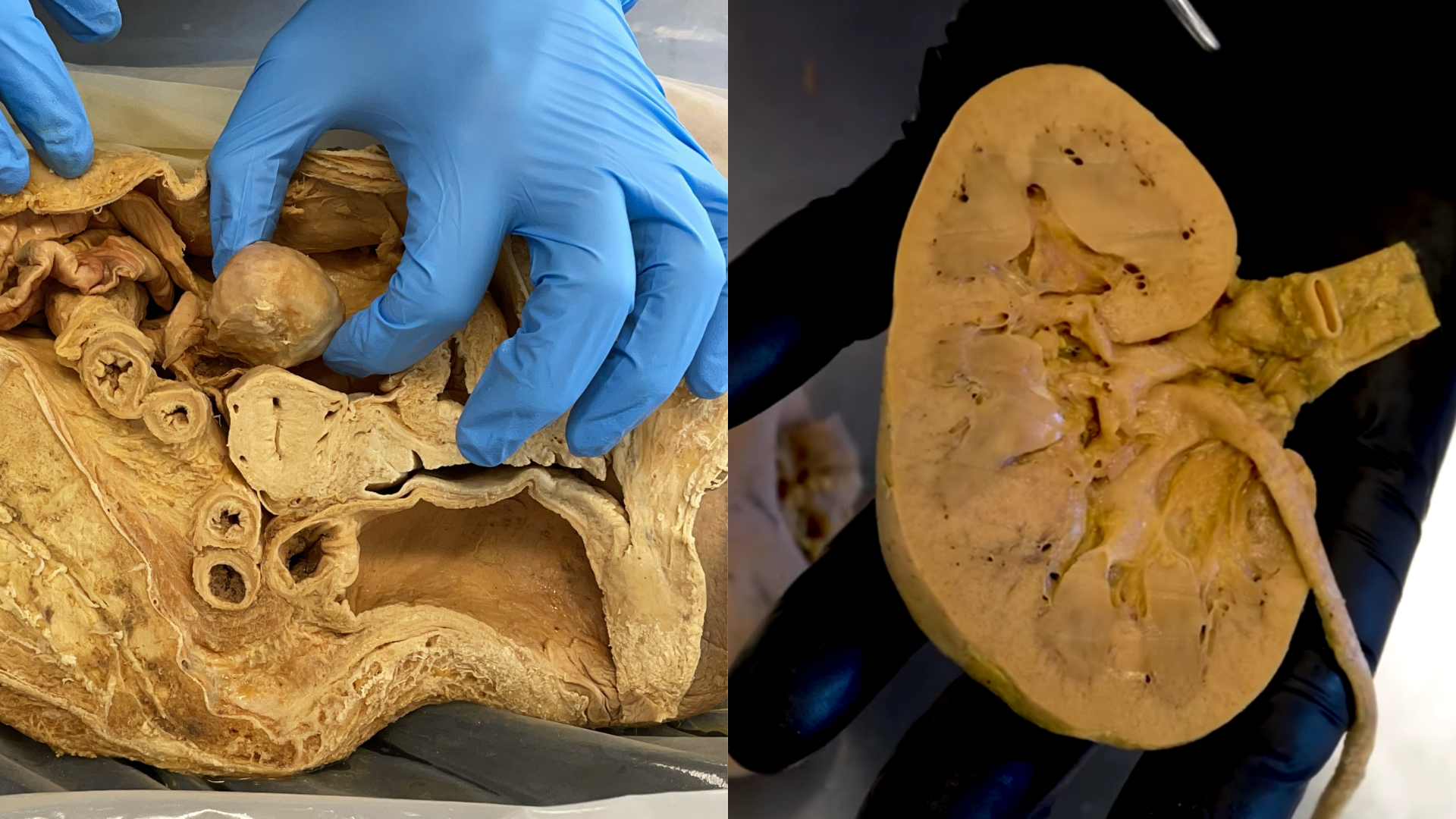 In-Lab workshop in Institute of Human Anatomy