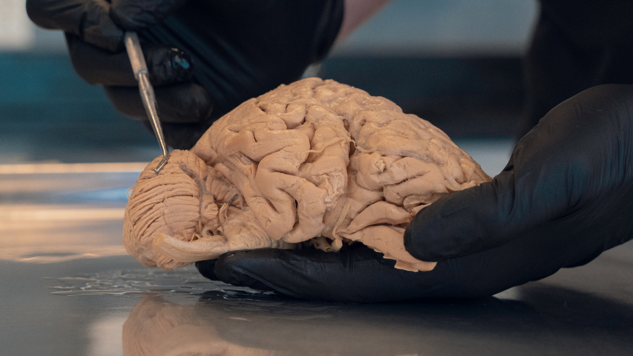 Medical student or anatomist conducting a human brain dissection using a probe during a cadaver lab anatomy lesson.