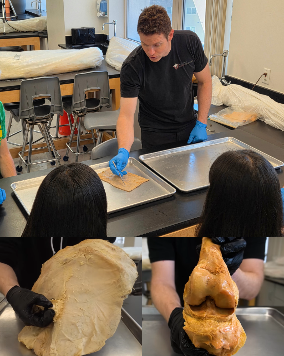 Skin, Connective Tissues, & Joints 2-Hour Workshop - Institute of Human Anatomy
