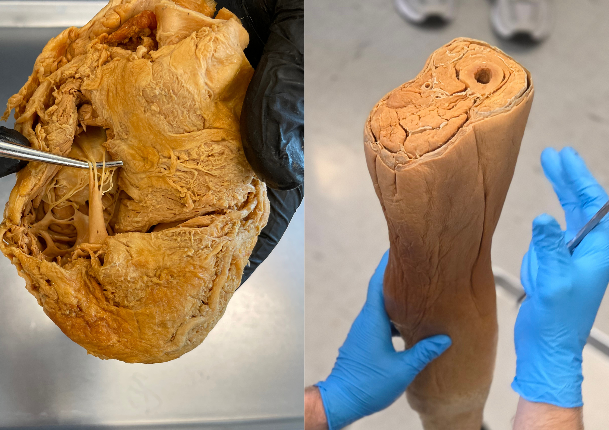 In-Lab workshop in Institute of Human Anatomy