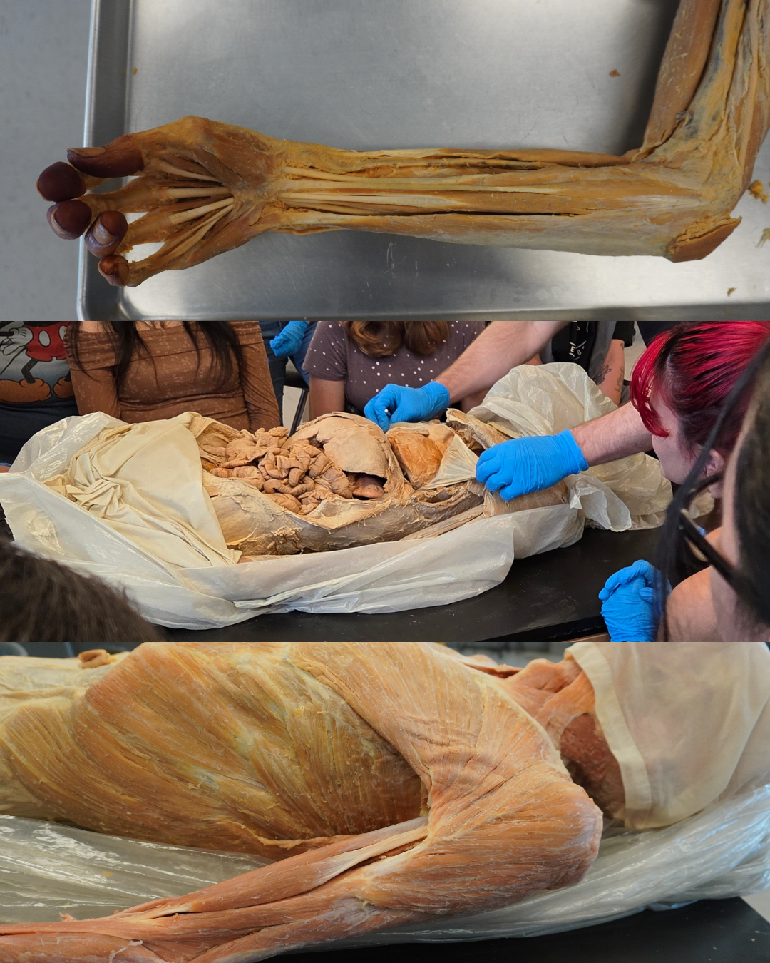 Musculoskeletal System: Superior Limb 2-Hour Workshop - Institute of Human Anatomy