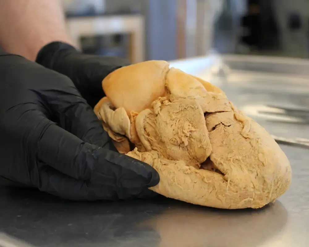 Real preserved cadaveric human heart specimen held for cardiovascular anatomy education at the Institute of Human Anatomy.
