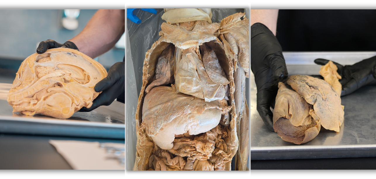 IOHA Live from the Lab: Anatomy Workshop