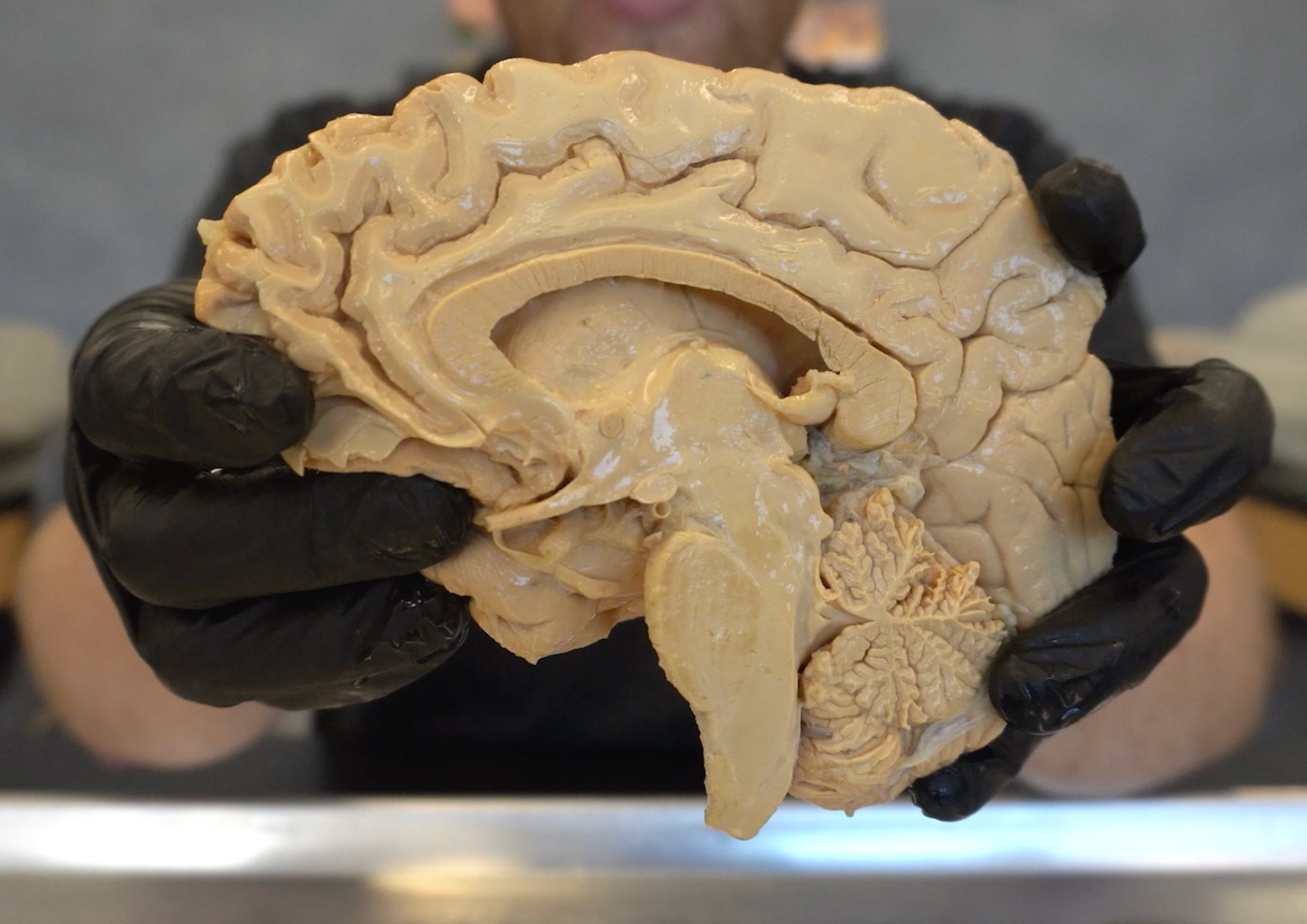 A midline sagittal section of a real human brain specimen held by a researcher wearing black gloves, showing the medial surface anatomy including the cerebral cortex, brainstem, and cerebellum.