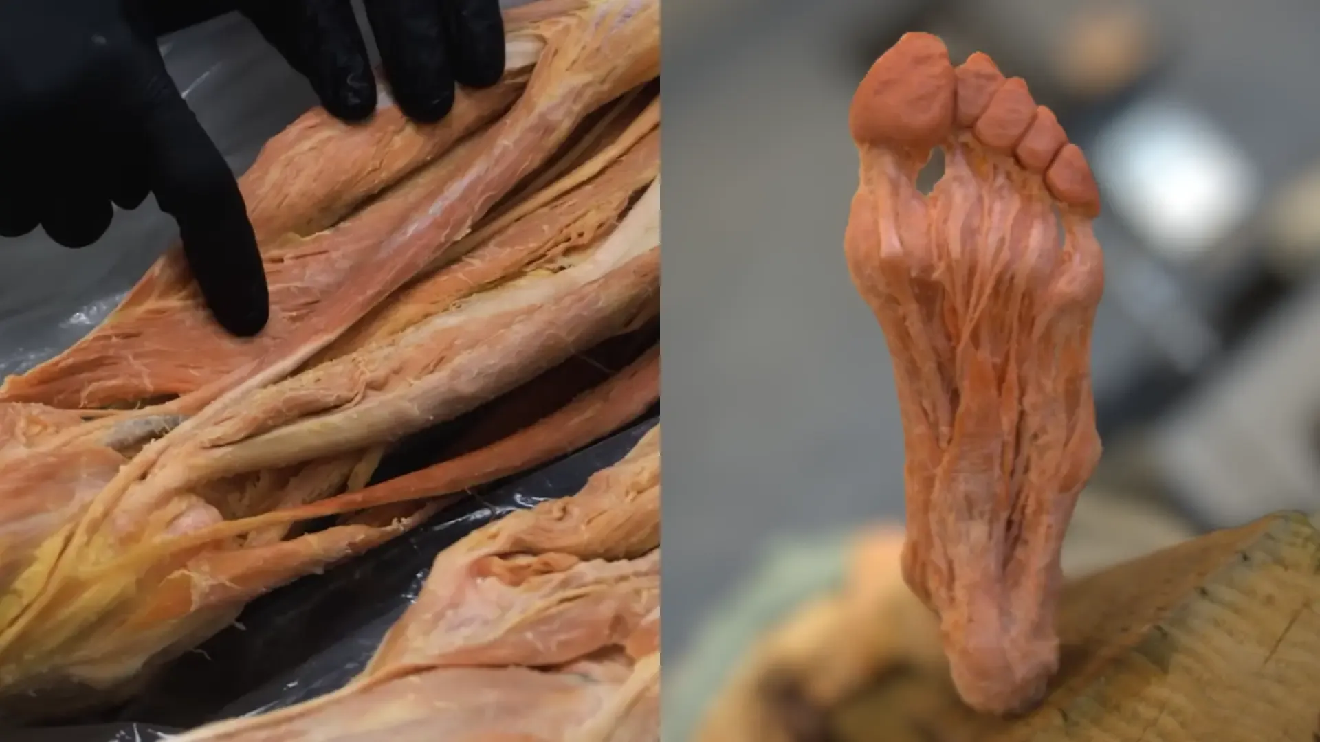 In-Lab workshop in Institute of Human Anatomy