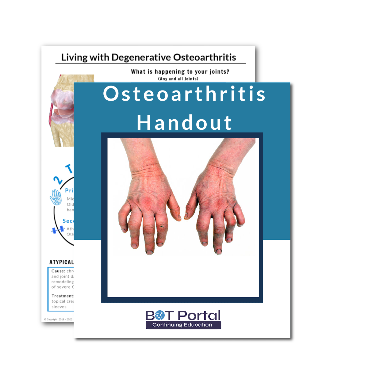 Degenerative Osteoarthritis