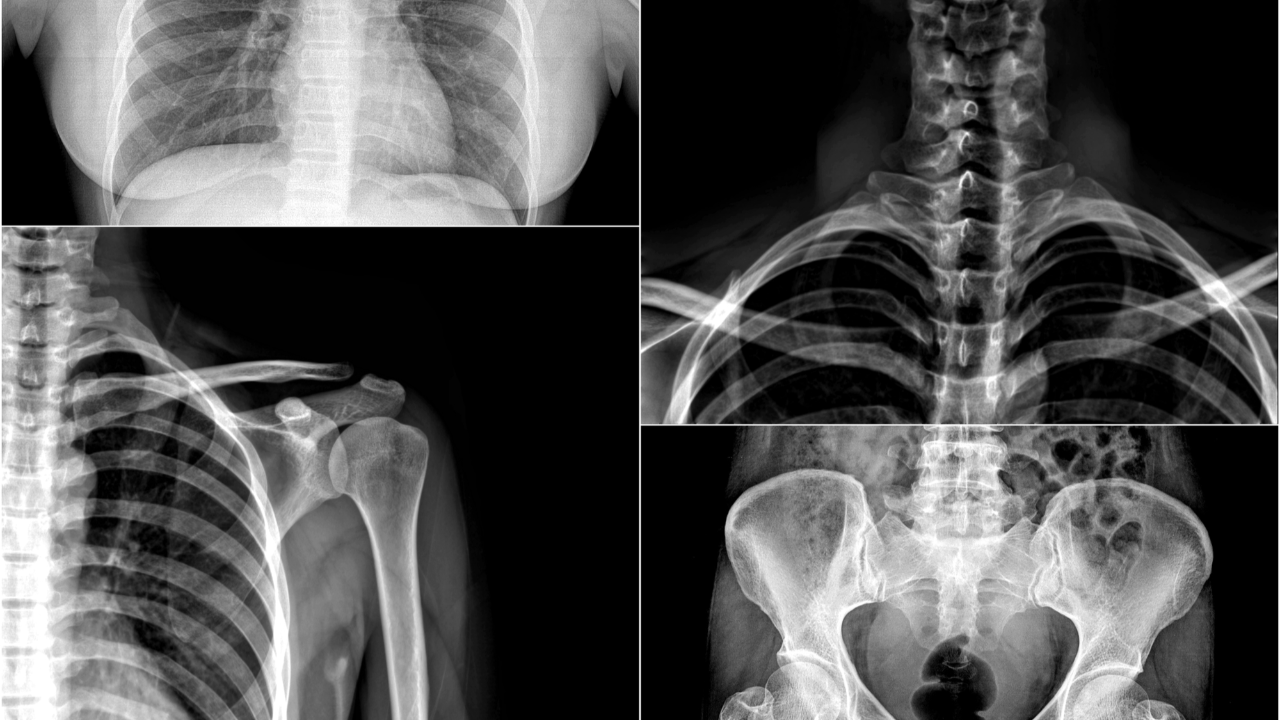 NBCE SPEC exam for chiropractors