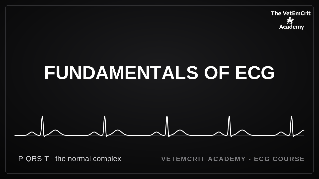 Fundamentals of ECG