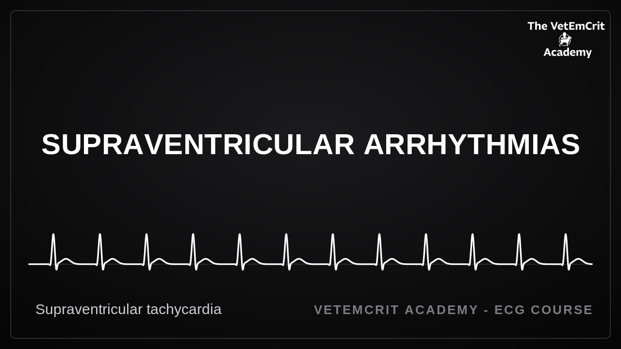 Supraventricular Arrhythmias