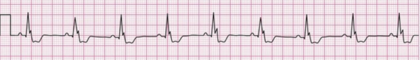 Canine ECG rhythm strip