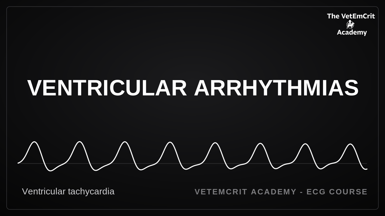 Ventricular Arrhythmias