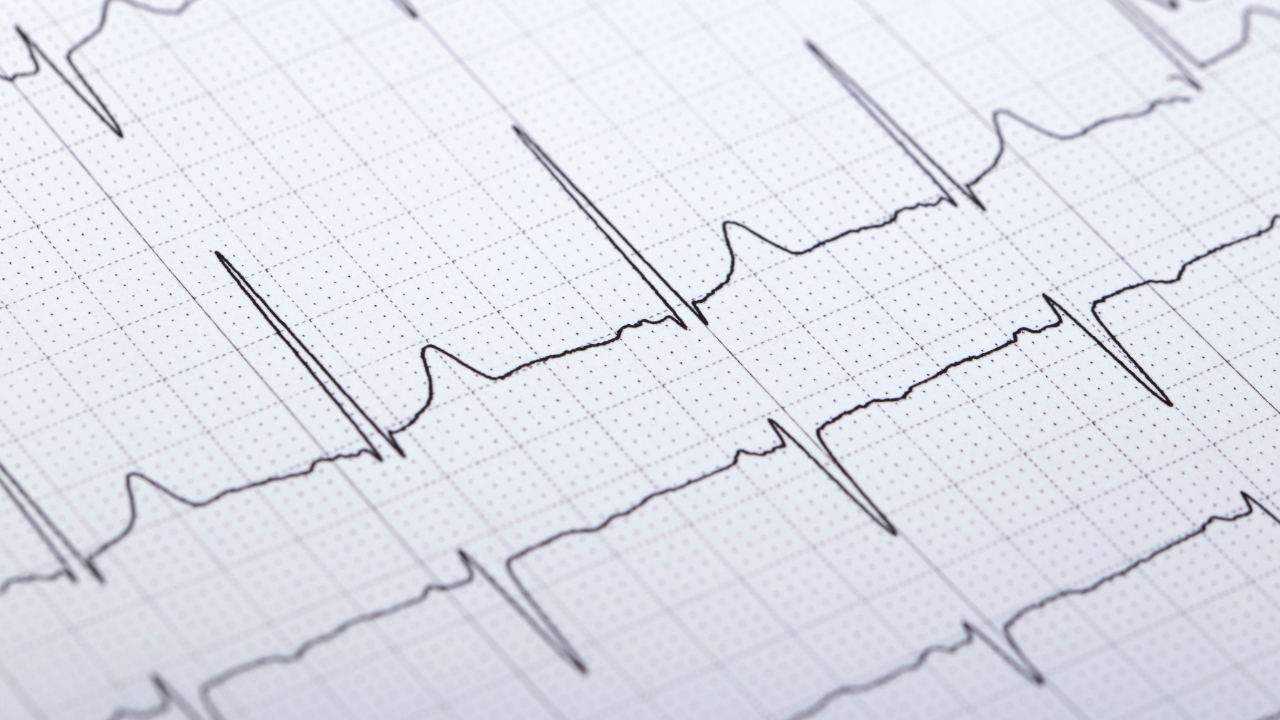 ECG Mastery: Online Training for Emergency & Critical Care Veterinarians