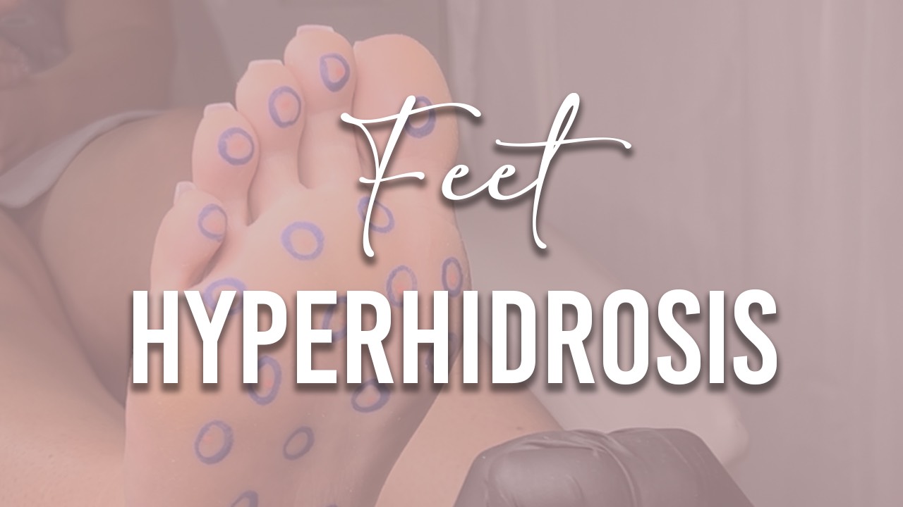 Online Hyperhidrosis Feet