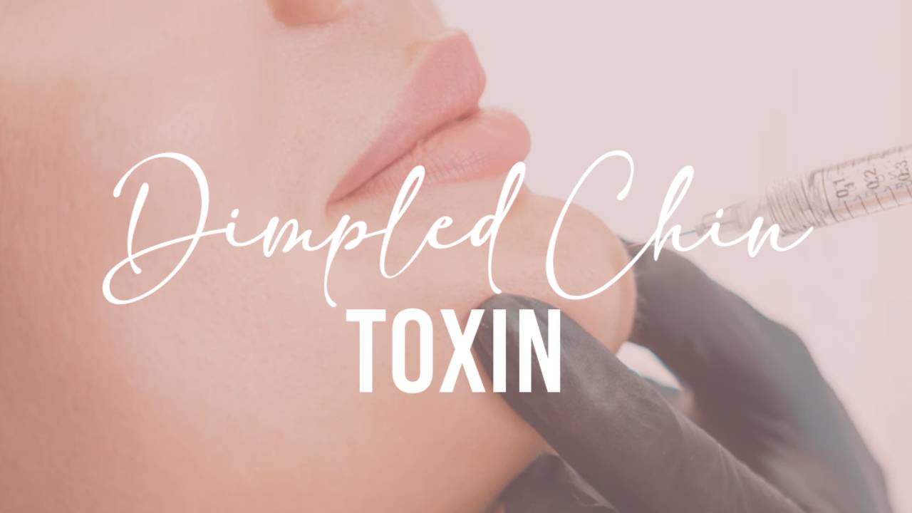 Online Dimpled Chin (Mentalis) Toxin