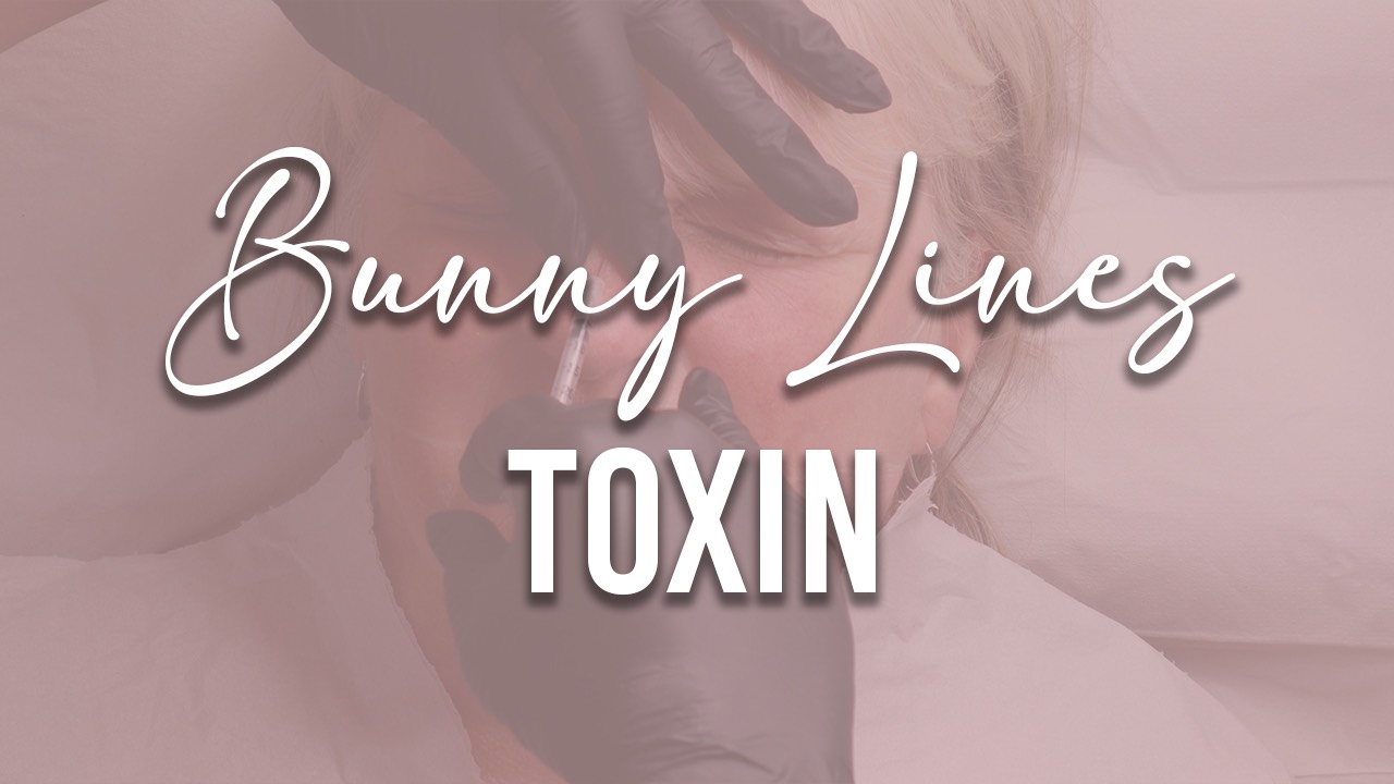 Online Bunny Lines Toxin