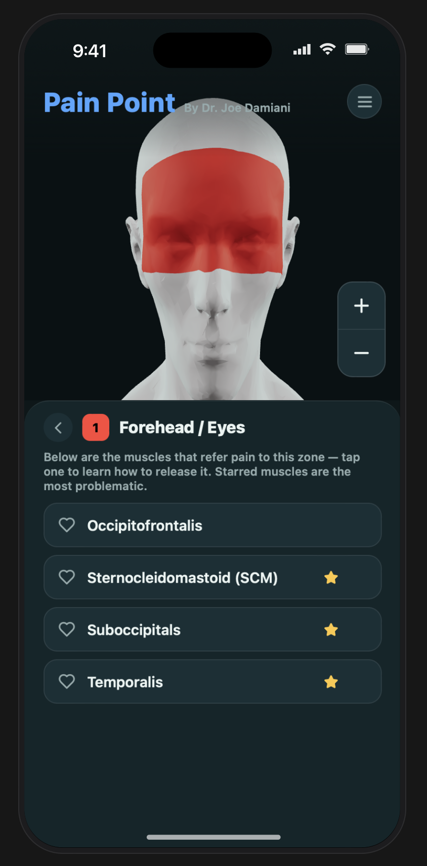 Forehead and eyes pain zone showing possible contributor muscles
