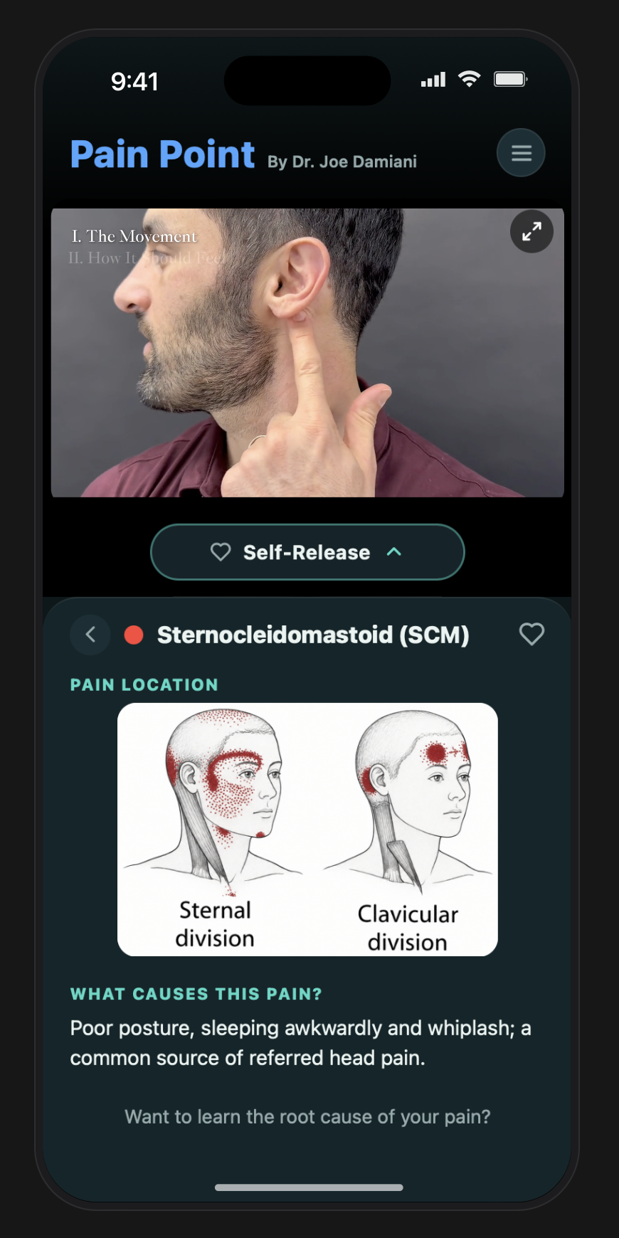 SCM muscle detail showing its common referred-pain pattern