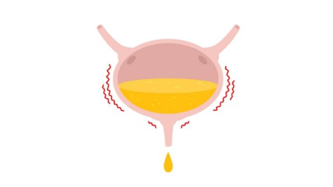 Why Do Women Leak Urine? How to Fix Urinary Incontinence
