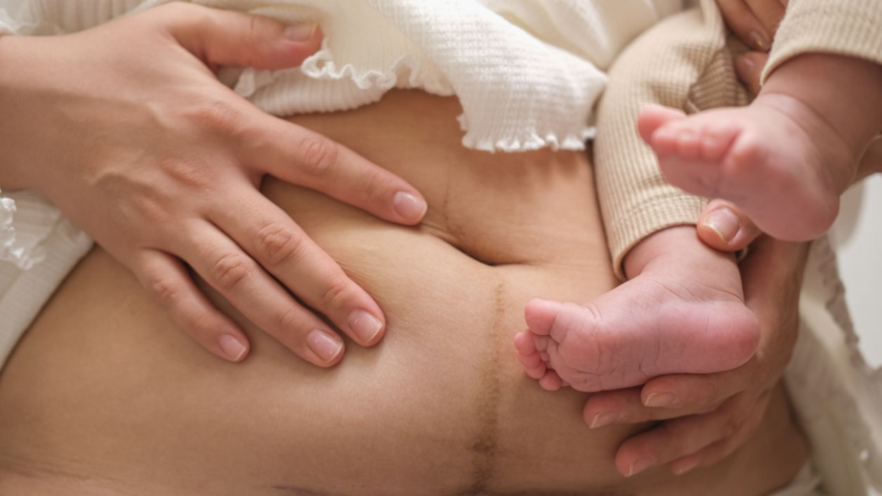 mom holding baby and touching c-section scar