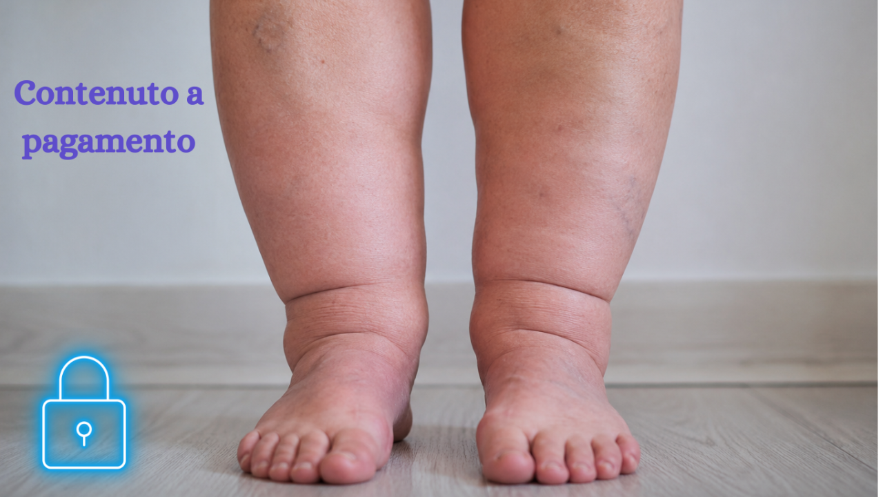 Linfoedema e Lipedema in menopausa