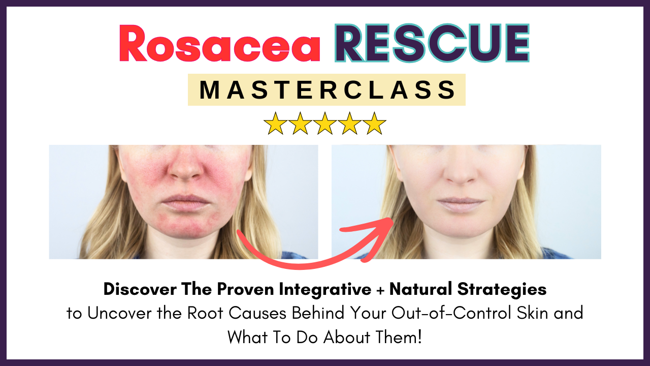 Rosacea Rescue Masterclass cover