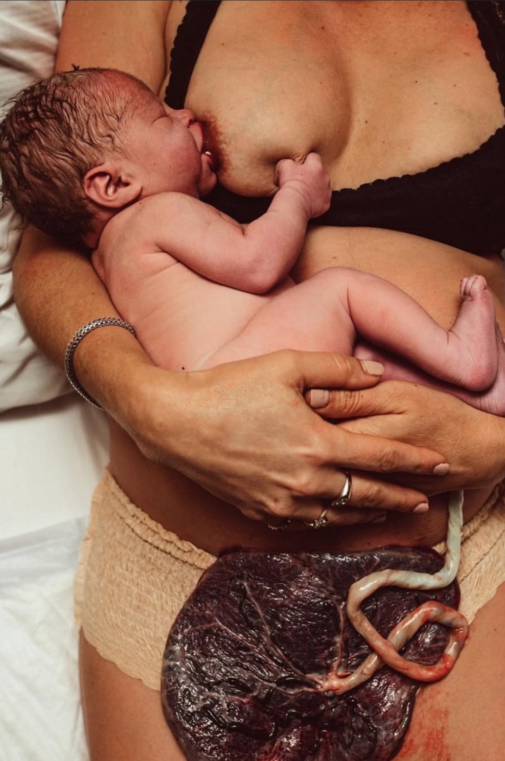 A newborn nursing at their mother's chest moments after birth.