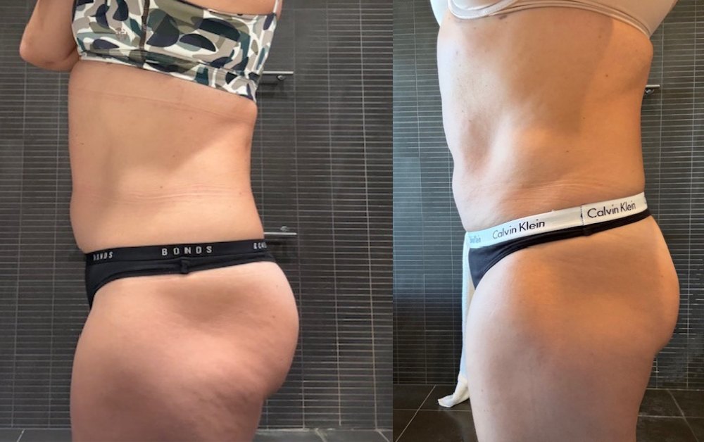 Results