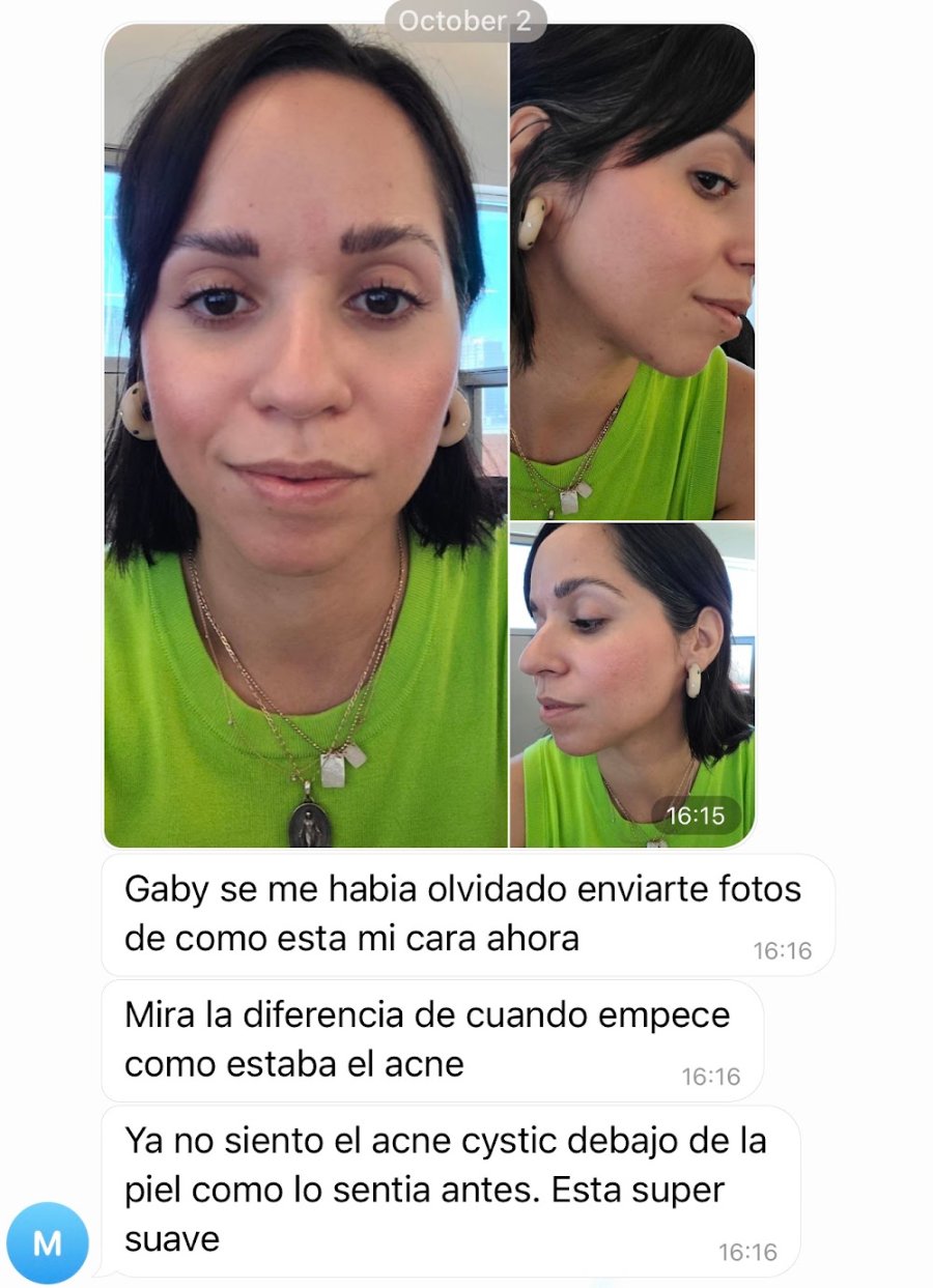 Chat con fotos del antes y después del acné de una paciente