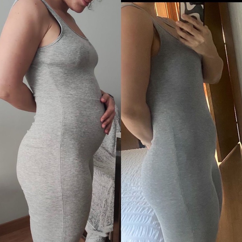 Antes y después real: Hinchazón abdominal