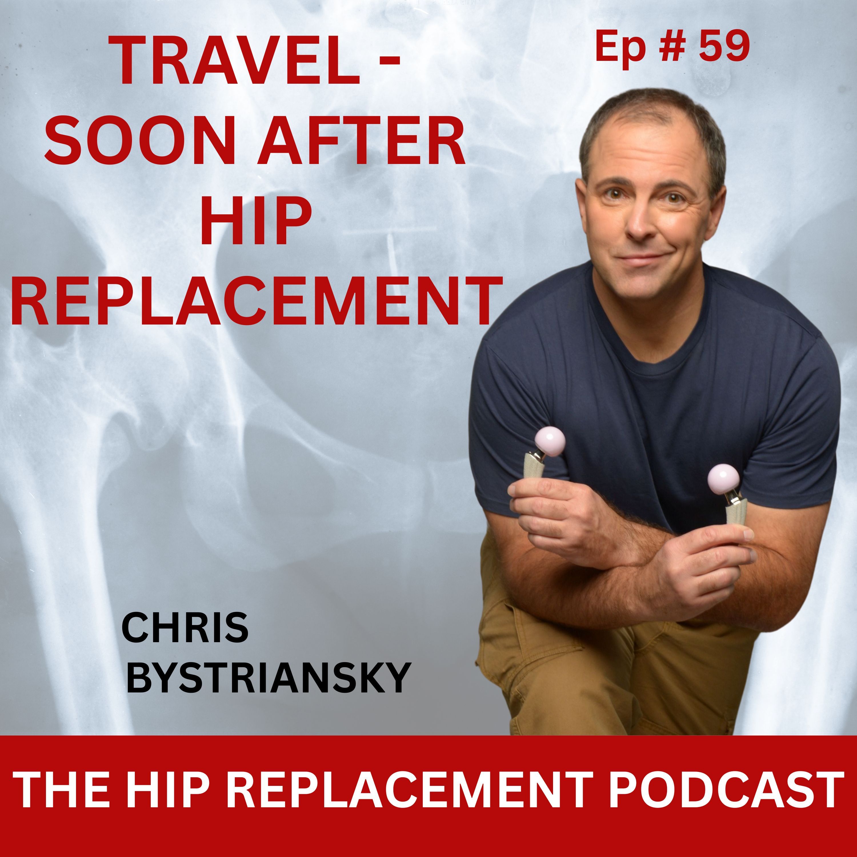 Travel - Soon After a Hip Replacement - Ep. 59 episode artwork
