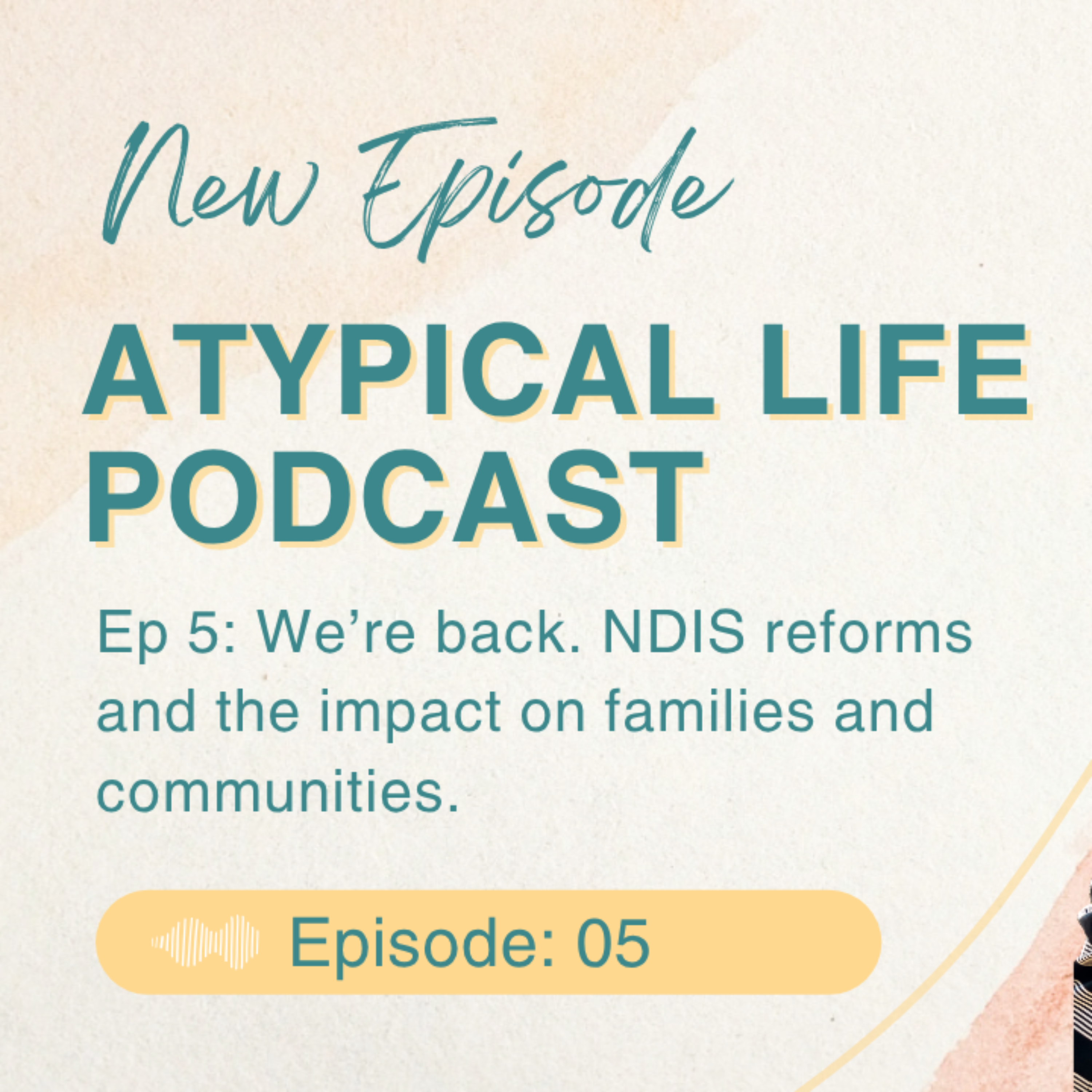 Play Atypical Life Podcast Season 1, Episode 5 - We're Back! Surgery, NDIS Chaos & a Small Win Worth Celebrating