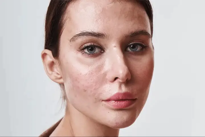Before and after: high-end skin retouching on a portrait