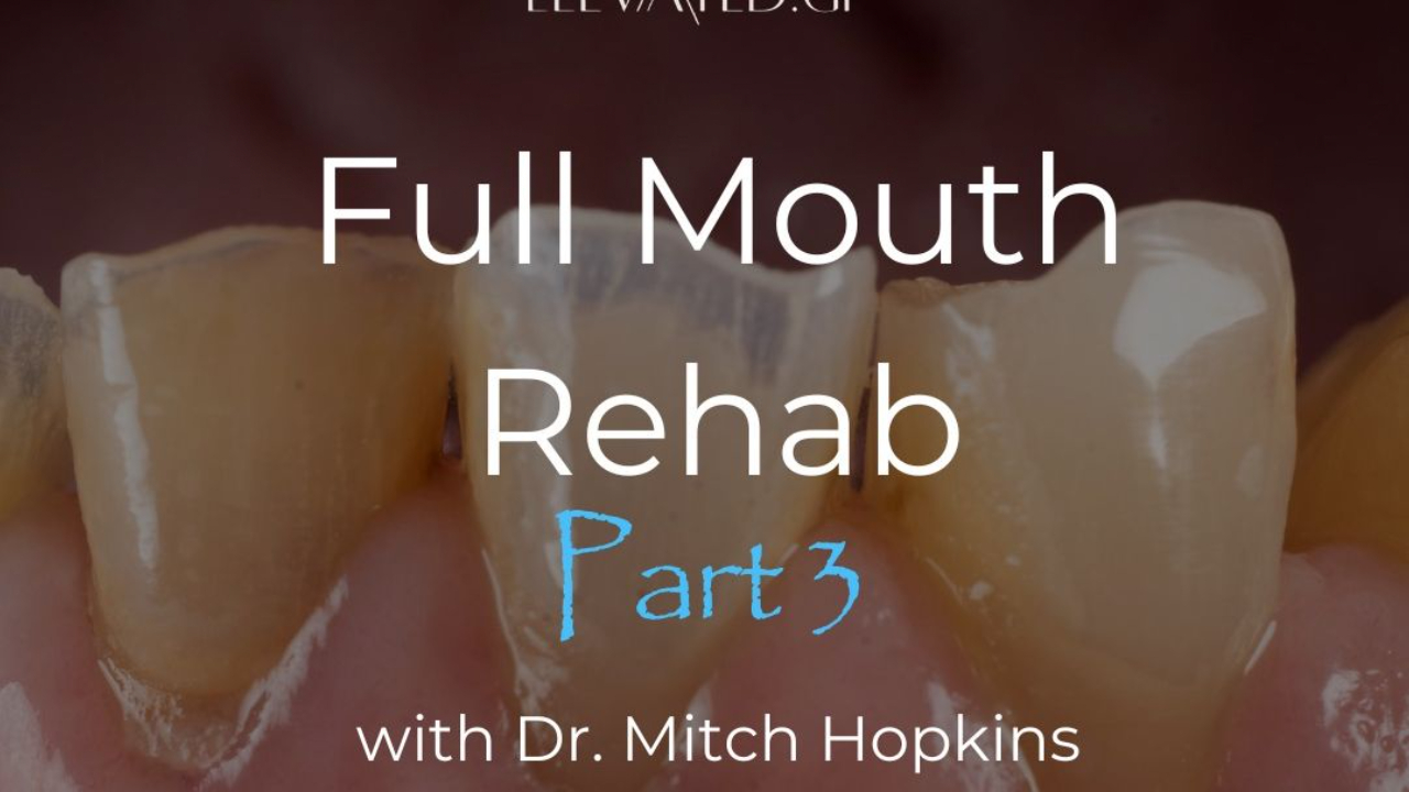 Full Mouth Rehabilitation Part 3 with Dr. Mitch Hopkins
