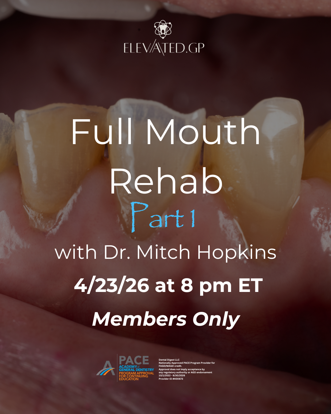 Full Mouth Rehabilitation Part I with Dr. Mitch Hopkins