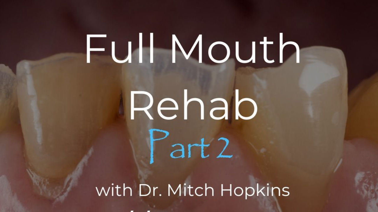 Full Mouth Rehabilitation Part 2 with Dr. Mitch Hopkins