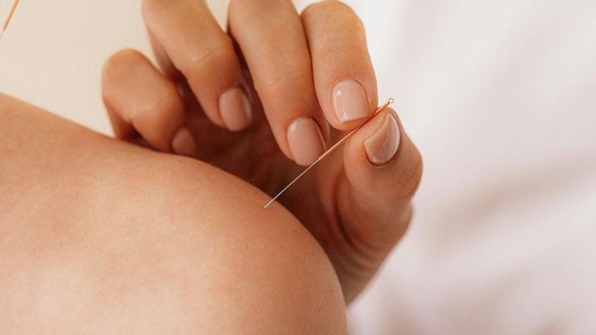 L’acupuncture en périnatalité : un allié précieux