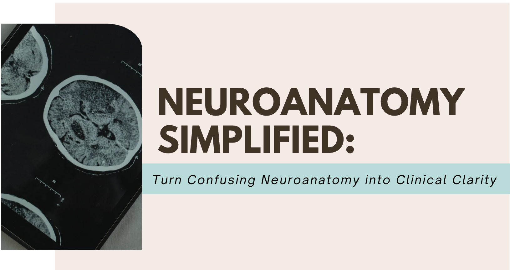 IGNITE lesson: Neuroanatomy Simplified