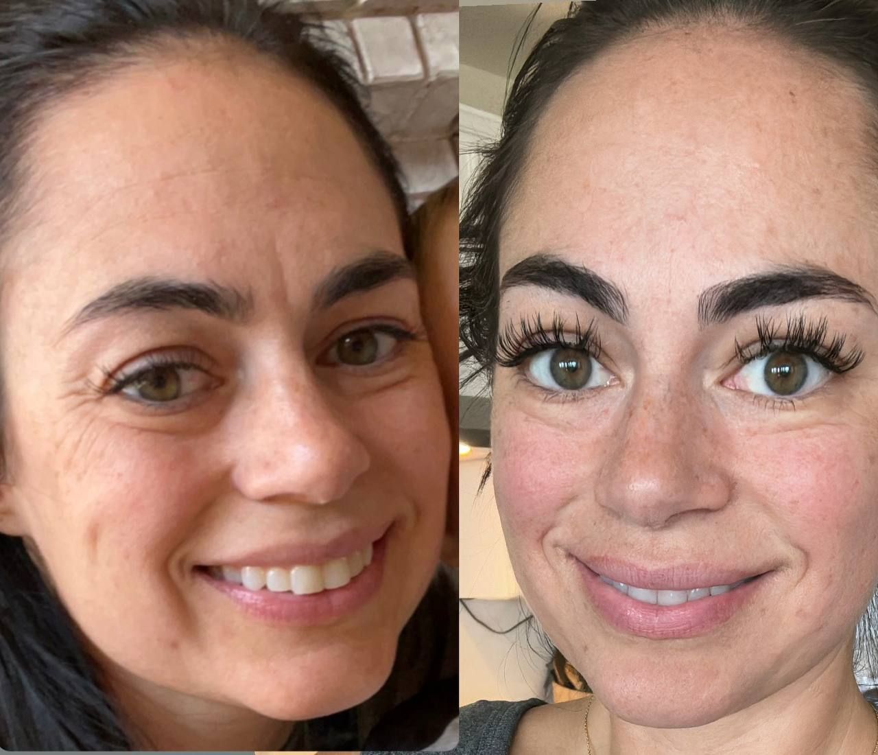 Allison's before and after photos