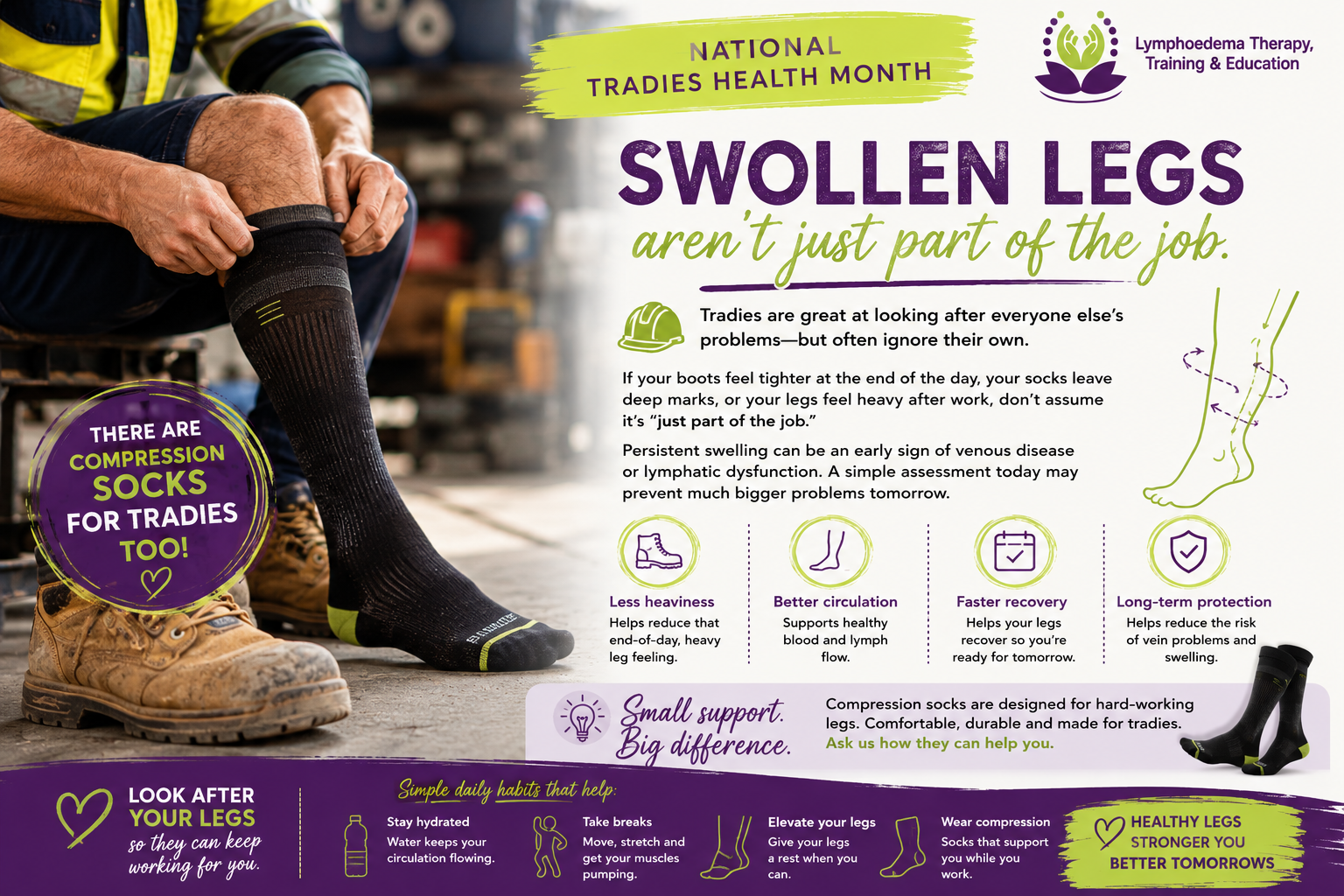 Swollen legs aren't just part of the job