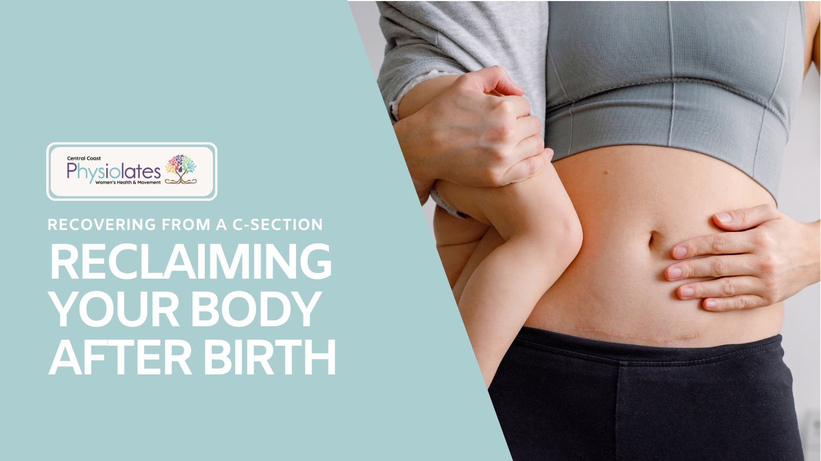 The Emotional & Physical Reality of C-Section Recovery: Reclaiming Your Body After Birth