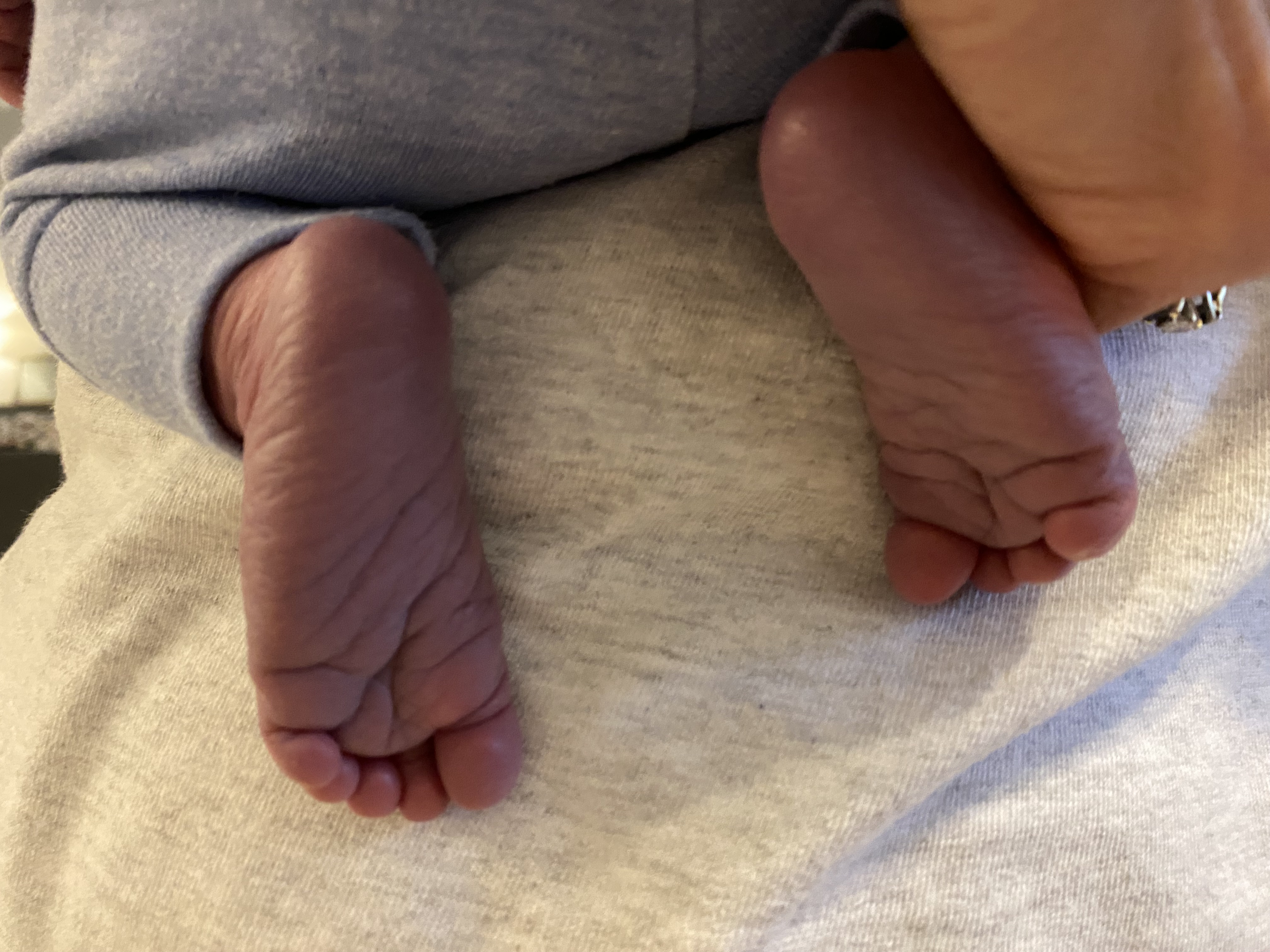 Close-up of a newborn's feet resting on a caregiver's lap, with a bluish-purple discoloration of the toes consistent with acrocyanosis; the baby is wearing a light gray outfit and the skin appears otherwise smooth and healthy.