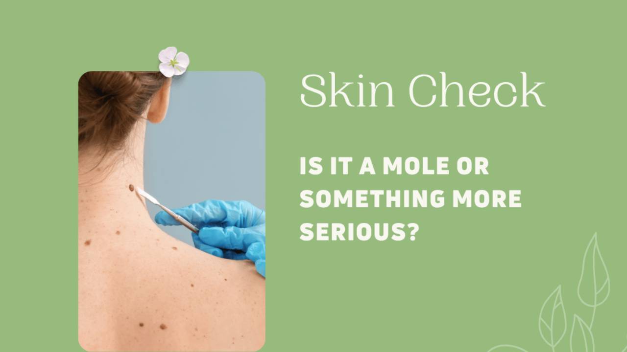 Is It a Mole or Something More? When to Get It Checked
