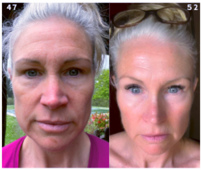 Liz before and after face yoga results