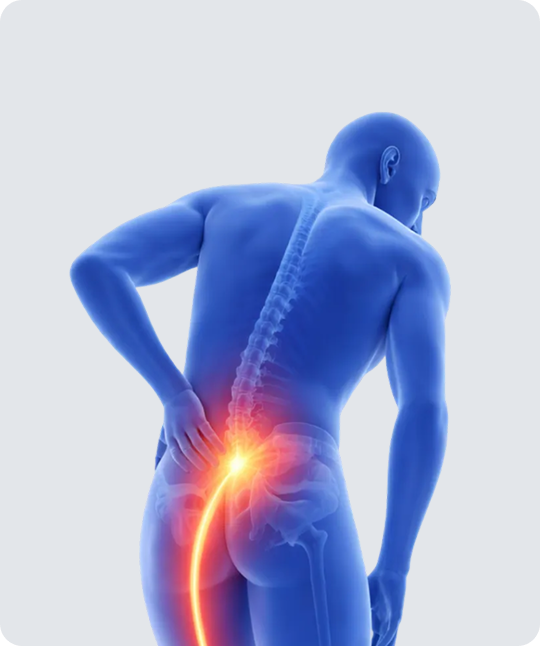 Sciatica
